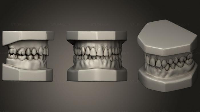 Статуэтки и статуи разные (Зубы, STKR_1803) 3D модель для ЧПУ станка